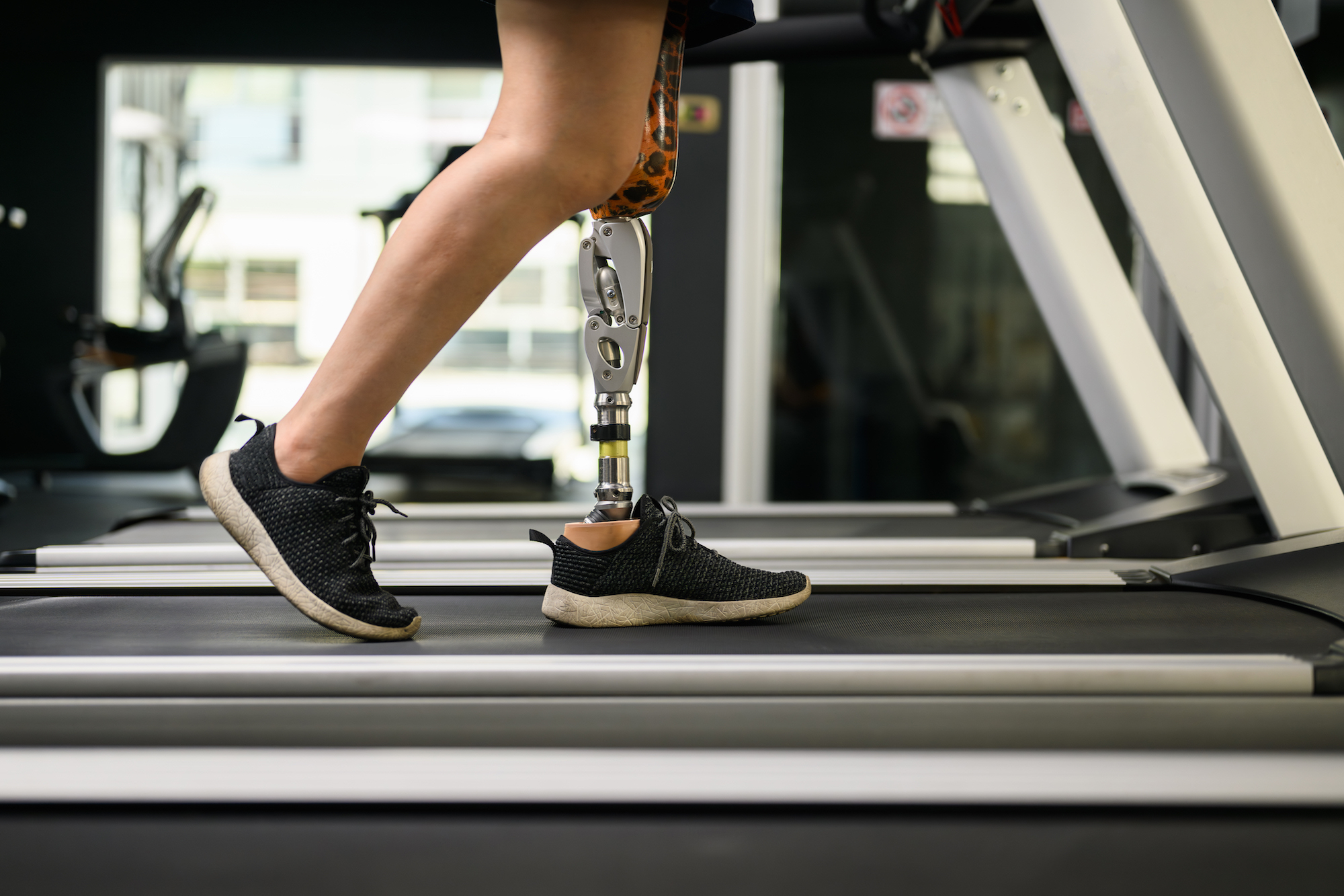 athlete on treadmill with prosthetic leg at gym.